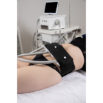 APPAREIL CRYOSKIN REV STATIQUE AUTONOME – Image 2